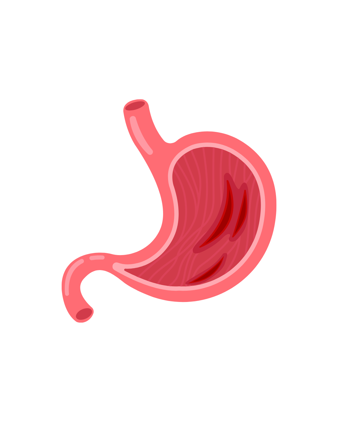 Endoscopia